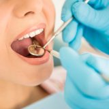 odontología en Alicante, tratamientos preventivos en Alicante, limpieza dental en Alicante.