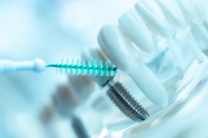 cuidados para implantes dentales